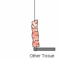 Other Tissue